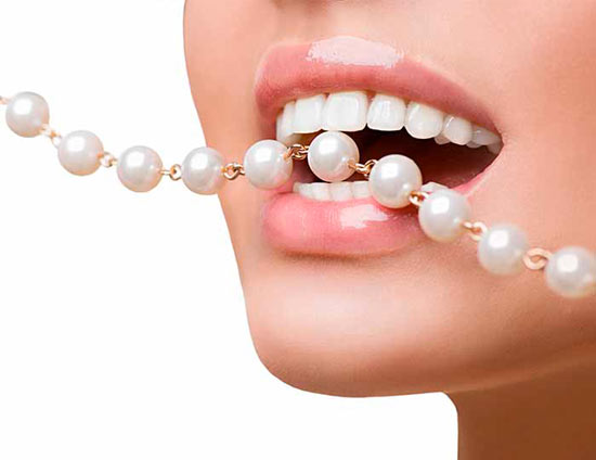faccette dentali