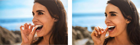 donna indossa invisalign