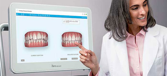 dottoressa mostra sistema invisalign