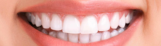 Sbiancamento denti